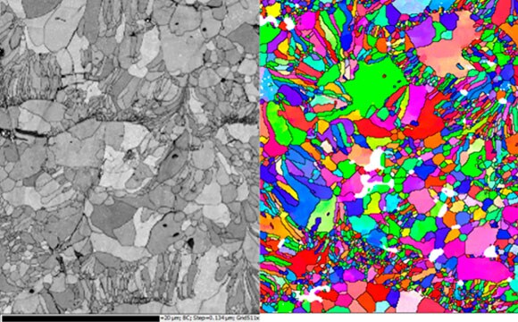 ChemiSEM image of dental filling material, showing a mixture of Hg, Cu, Sn and Ag.