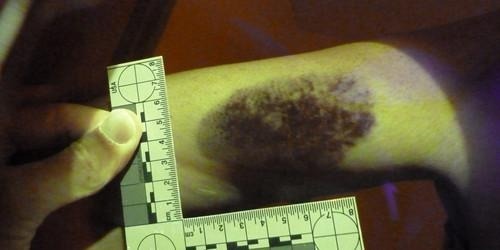 Automated Fingerprint and Palmprint Identification with the PrintQuest