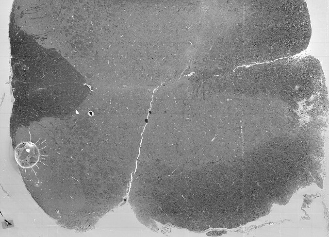 cross section of spinal cord