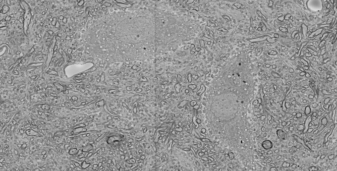 motor neurons of the same spinal cord